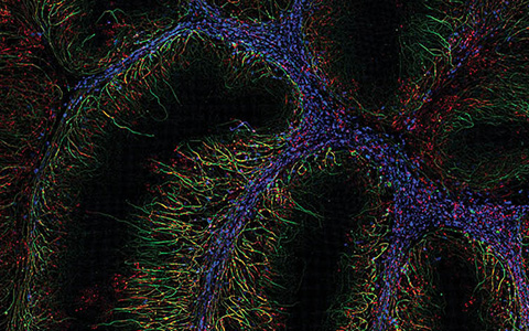 奥林巴斯显微镜SEO优化